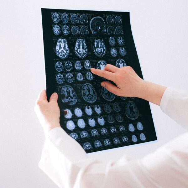 Doctor examines brain MRI scans closely for medical diagnosis in a hospital environment.